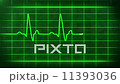 Ekg Heart Monitor HD 11393036