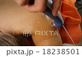 Ultrasound therapy on the shoulder of a young woma 18238501