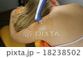 Ultrasound therapy on the shoulder of a young woma 18238502