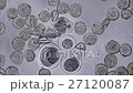 スギ花粉が水に濡れ殻を破りアレルゲンを含む内容物を出すところ 27120087
