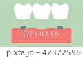 dental implant with bridge 42372596