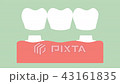 dental crown with bridge 43161835