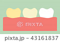 yellow to white tooth, teeth whitening concept 43161837