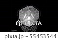 Brain Scan 55453544