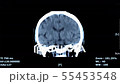 Brain Scan 55453548