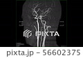 MRI of the blood vessels in the brain 56602375