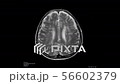Brain Scan 56602379