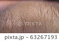 Human Skin  63267193