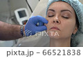 Doctor's hands in blue gloves with a syringe. The doctor gives an injection to the cheek area. Doctor's hands in blue gloves with a syringe. The doctor gives an injection to the cheek area. 66521838
