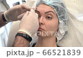 The doctor inserts a medical drug into the skin of the forehead with a syringe The doctor inserts a medical drug into the skin of the forehead with a syringe 66521839