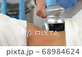 Cavitation Treatment 68984624