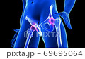 Hip Pain close-up animation. Blue Human Anatomy Body 3D Scan render - seamless loop on black background 69695064