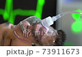 Young man is breathing with oxygen mask on face in hospital during covid-19 pandemic. 73911673