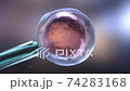 Artificial insemination or in vitro fertilization 74283168