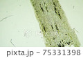 Microscopic video of radish stem (40x or less) 75331398