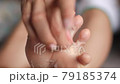 female feet during an acid peeling procedure.skin renewal and regeneration. skin restoration. foot care. health and hygiene. Tear off pieces of skin with your hands. 79185374