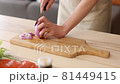 Hands to cut onions with a kitchen knife 81449415