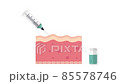 Syringe injecting in skin with wrinkles and fine lines animation. Skincare, beauty, rejuvination concept. For topics like anti-aging therapy, biorevitalization and mesotherapy 85578746