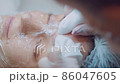 close up hands of cosmetologist cleanses the face female patient of acne. skin care. Facial cleaning 86047605