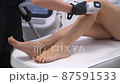 Laser epilation - hair removal procedure. Slider shooting 87591533