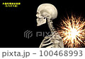 むち打ち発症時における骨格の動態変化動画 100468993