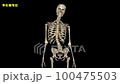 脊柱側弯症による脊柱変形動画 100475503