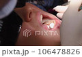 Applying resin based composite filling on tooth. Young woman at dental clinic. Female dentist with assistant treating cavities in a patient mouth in modern dental office. 106478826
