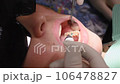 Applying blue liquid disinfectant with syringe on tooth after drilling. Young woman at dental clinic. Female dentist with assistant treating cavities in a patient mouth in modern dental office. 106478827