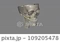 The zygomatic branch is the most important for eye closure and commissure elevation 109205478
