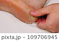 Cracked heel, rough skin on the foot. Slow motion. Man touches the cracking and peeling of the skin on the heels feet. Skin problem. Dermatology disease. Feet require medical care, pedicure. Close-up 109706945