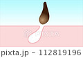 毛孔中的污垢、皮膚橫切面、角蛋白塞動畫 112819196