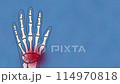 Charming Cartoon Anatomy: Hand Bone with Painful Finger Highlight 114970818