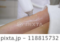 Beautician performing laser hair removal treatment on leg. 118815732