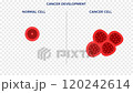 Normal and Cancer Cell Animation, Cancer development. Normal cells are transformed into cancer. 120242614