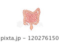 POLYPS OF THE COLON Intestines Medicine Anatomical Video Scheme Animation for Education 120276150