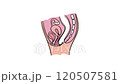 PROLAPSED RECTUM Of Women Animated Medical Education Scheme For Students Of University  120507581