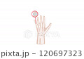 RHEUMATOID ARTHRITIS DISEASE VIDEO Chronic Disease Medicine Education Animated Diagram Of Human Hand For Medical Students 120697323