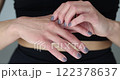 Woman scratching itchy hand and wrist pain 122378637