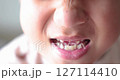 Close up of kid smiling with missing front tooth, child dental care, milk teeth falling out, childhood oral health, happy boy showing tooth gap, first lost tooth, growing up concept. 4K video. 127114410