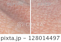 Skin surface before and after wrinkle reduction. Result after using anti-aging cream or serum, collagen boosting laser treatment, dermal filler injections, PRP therapy, EMS, or other beauty procedures 128014497