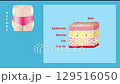 Mechanism of liposuction. Suction-assisted liposuction. Hollow tube or cannula, which is inserted through a small incision in the skin in order to fat suctioned out of the body. 3D animation 129516050