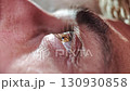 Medical eye drop falling onto a human eyeball for treatment. 130930858