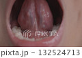 Oral cavity and tongue movements in infants 1 132524713