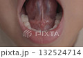 Oral cavity and tongue movements in infants 2 132524714