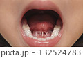 Oral cavity and tongue movements in infants 2 132524783