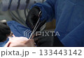 Close-up. surgeon's hands, black gloves, perform operation remove impacted wisdom tooth together assistant, nurse. Saliva ejector blood. Surgical suit, uniform. wound mouth sutured clamp. Sleep 133443142