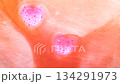 Image of two hearts 134291973