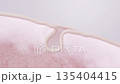 Anti-aging care CG showing bakuchiol serum tightening sagging pores and providing elasticity 135404415