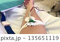 Donor's arm undergoing plasmapheresis procedure with needle and tubing 135651119