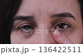 Adult Woman Showing Dark Circles Fatigue Anti Aging Concept 136422511